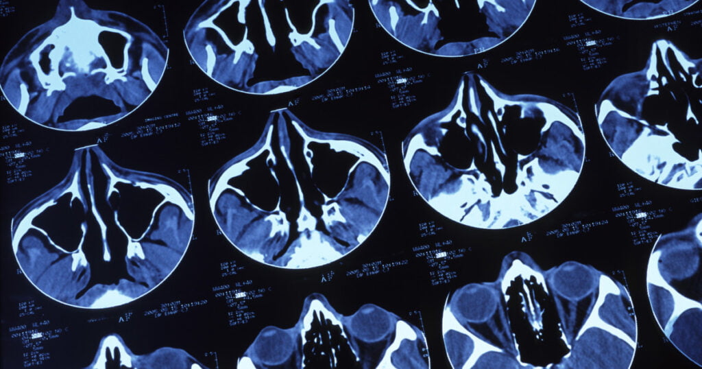 Cancer in Cats Symptoms