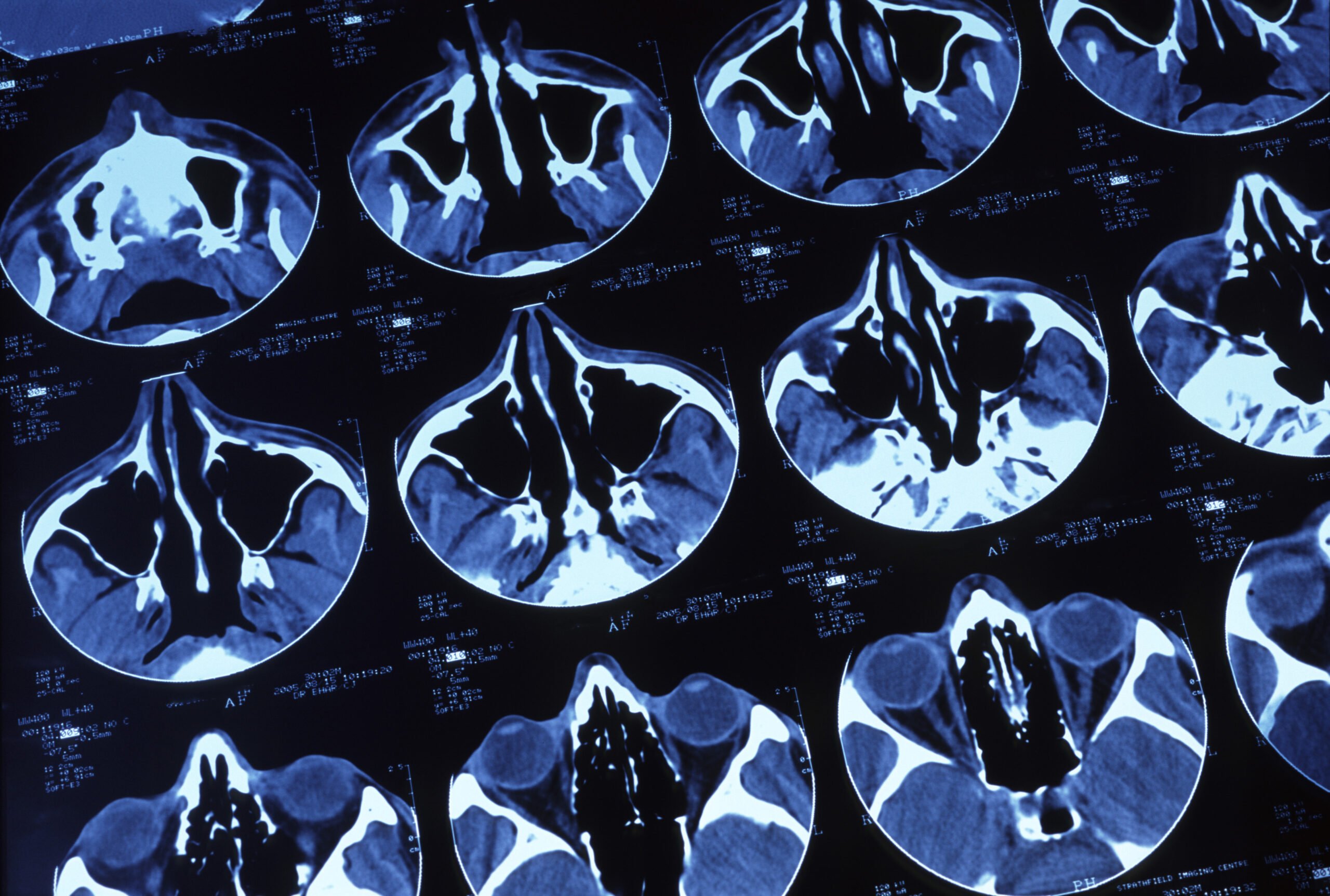 Cancer in Cats Scan